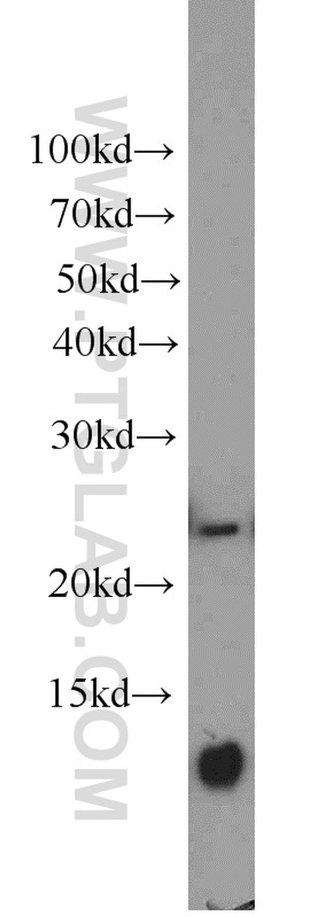 PAIP2 Antibody in Western Blot (WB)