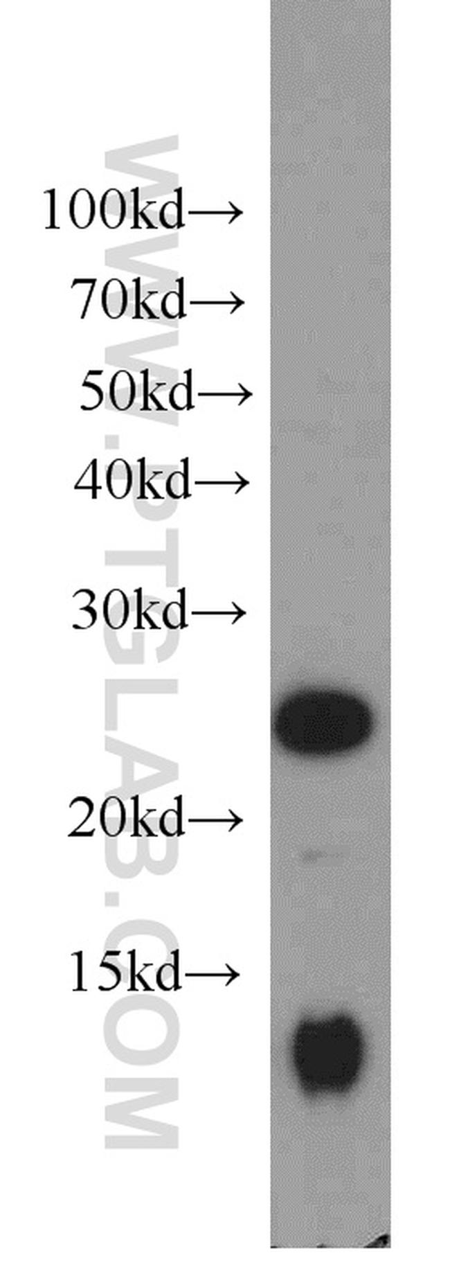 PAIP2 Antibody in Western Blot (WB)