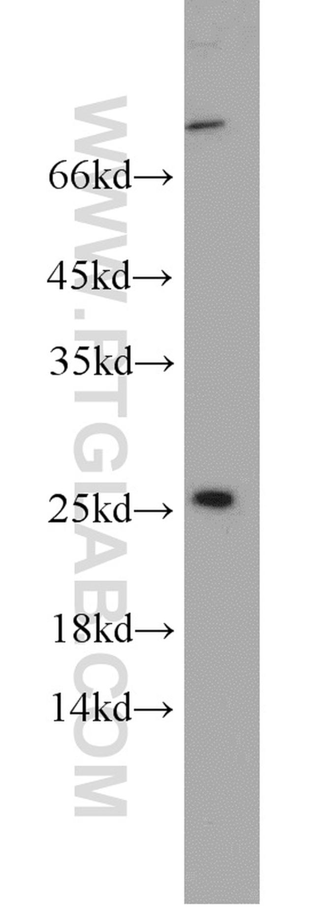 PAIP2 Antibody in Western Blot (WB)