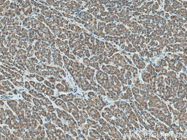 FDXR Antibody in Immunohistochemistry (Paraffin) (IHC (P))