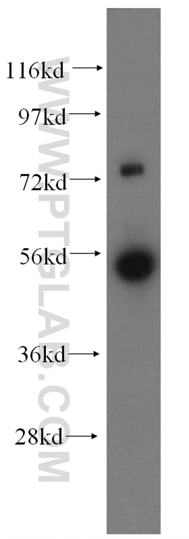 FDXR Antibody in Western Blot (WB)