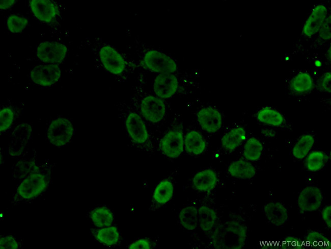 SFPQ Antibody in Immunocytochemistry (ICC/IF)