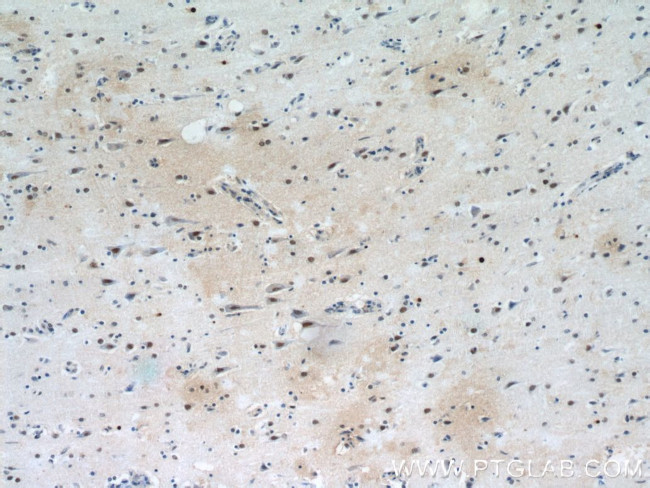 SFPQ Antibody in Immunohistochemistry (Paraffin) (IHC (P))