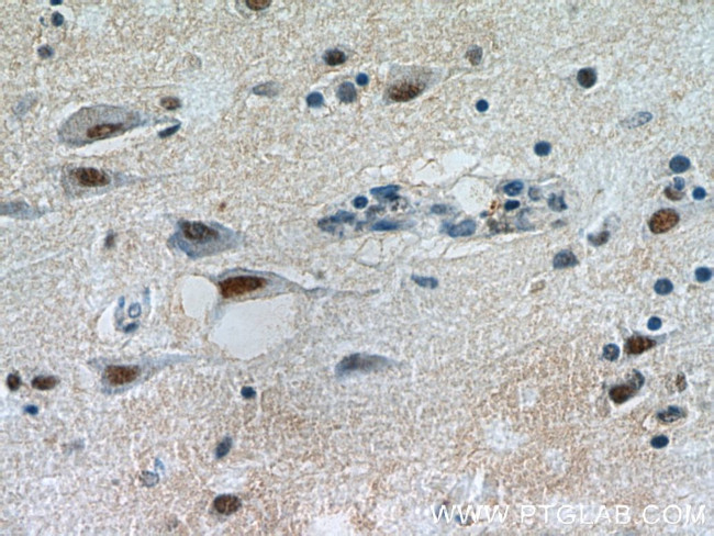 SFPQ Antibody in Immunohistochemistry (Paraffin) (IHC (P))