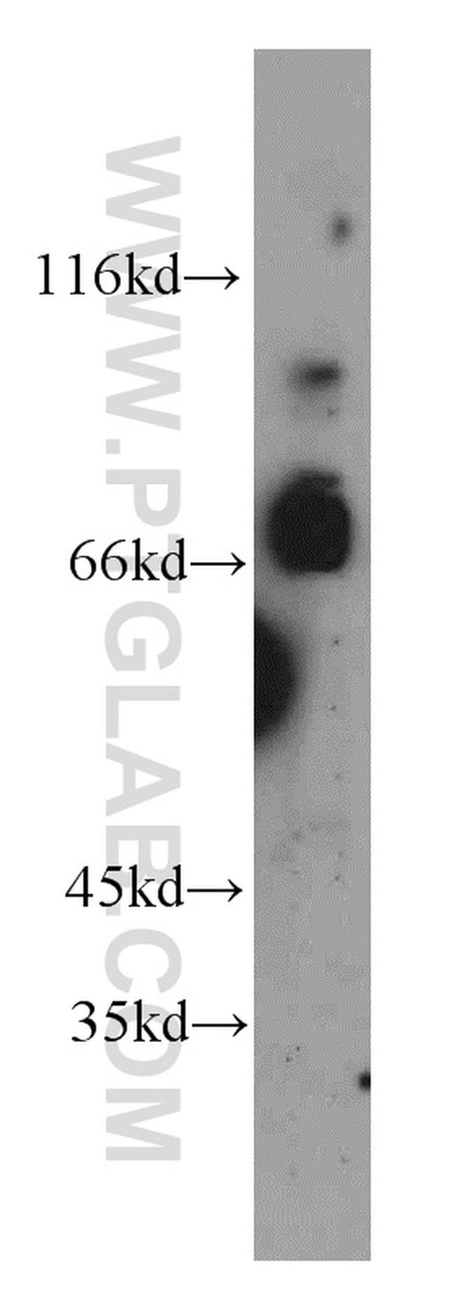 SFPQ Antibody in Western Blot (WB)