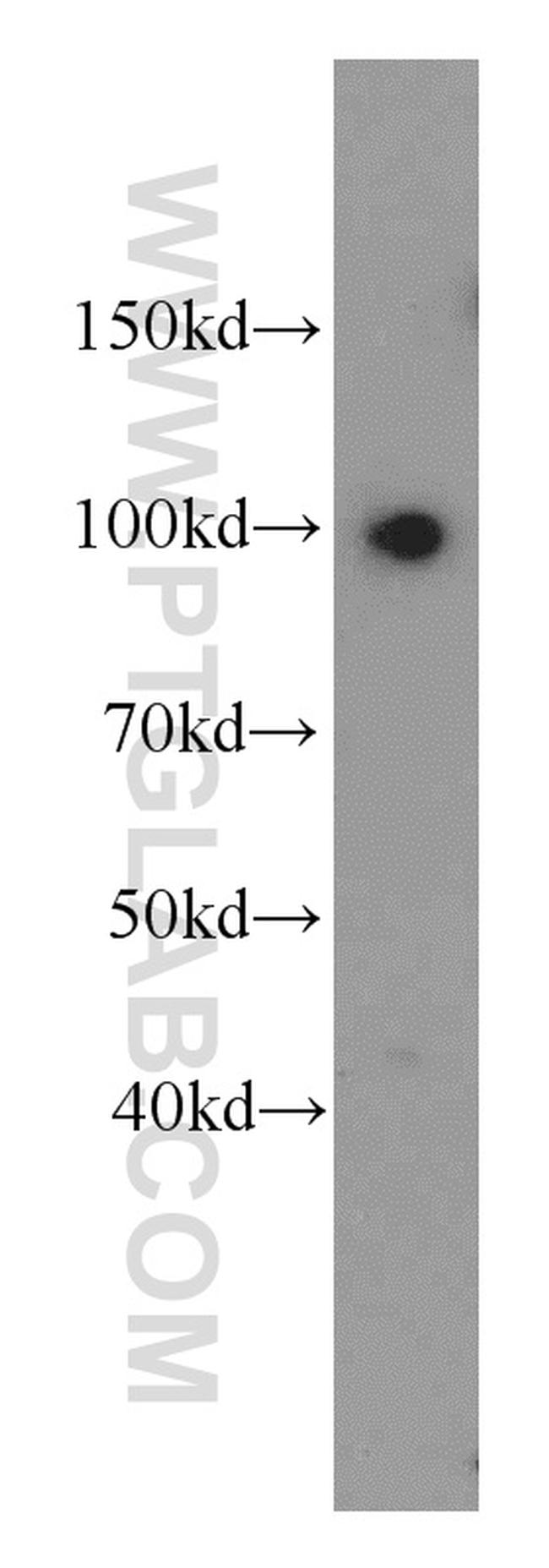 SFPQ Antibody in Western Blot (WB)