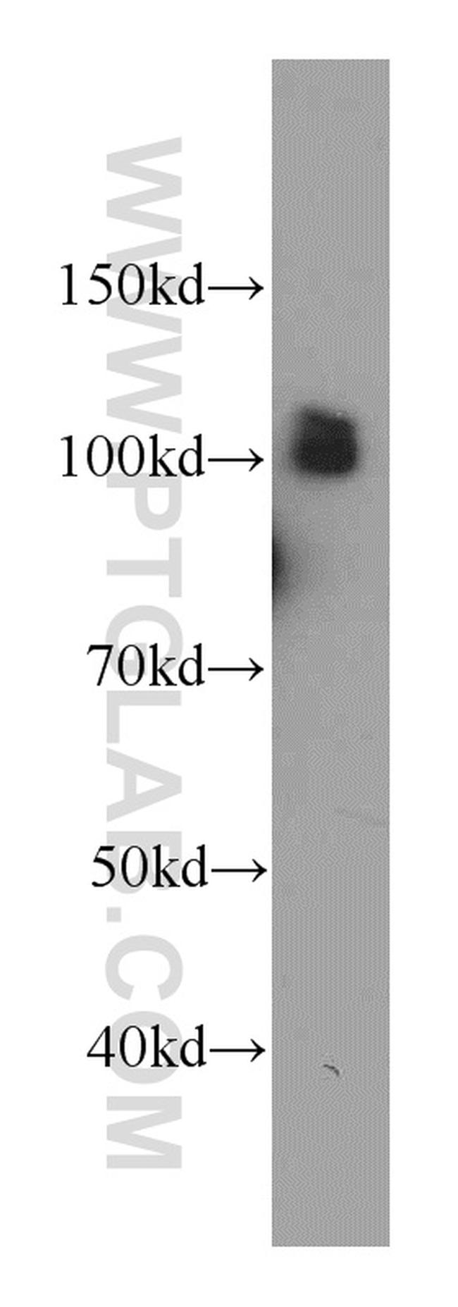 SFPQ Antibody in Western Blot (WB)