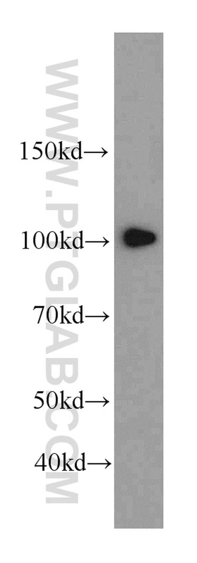 SFPQ Antibody in Western Blot (WB)