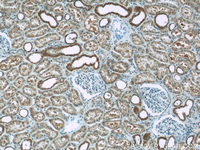 NDUFB10 Antibody in Immunohistochemistry (Paraffin) (IHC (P))