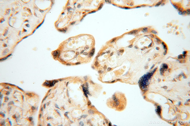 NDUFB10 Antibody in Immunohistochemistry (Paraffin) (IHC (P))