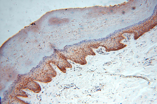 NDUFB10 Antibody in Immunohistochemistry (Paraffin) (IHC (P))