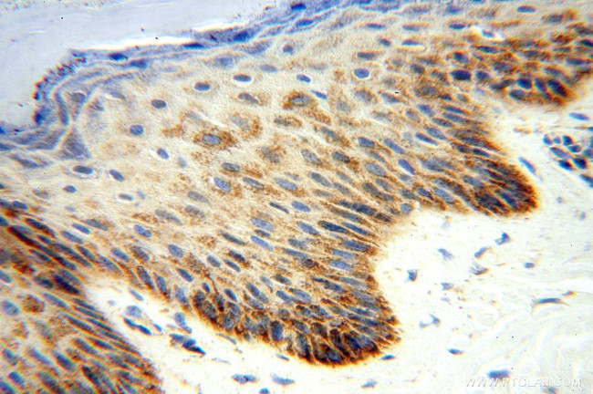 NDUFB10 Antibody in Immunohistochemistry (Paraffin) (IHC (P))