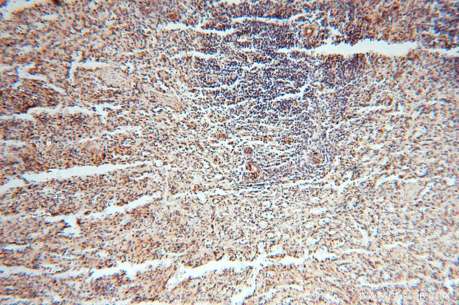 NDUFB10 Antibody in Immunohistochemistry (Paraffin) (IHC (P))