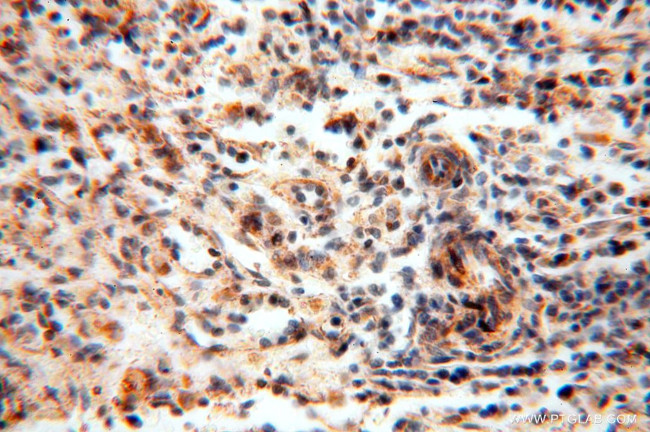 NDUFB10 Antibody in Immunohistochemistry (Paraffin) (IHC (P))