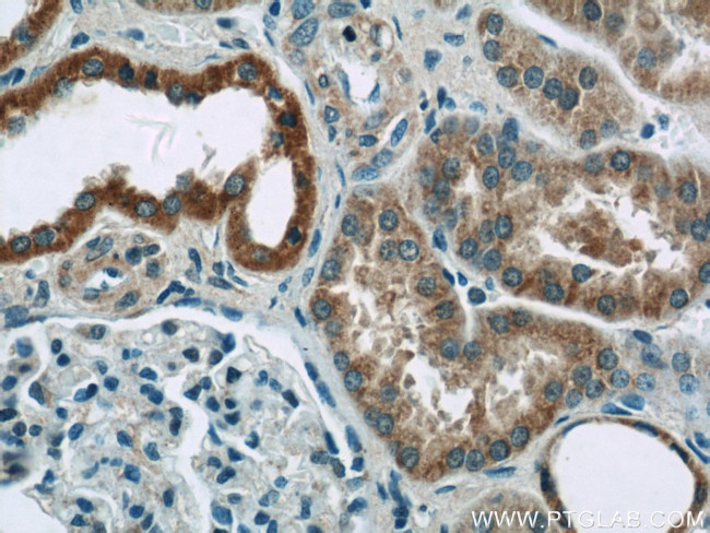 NDUFB10 Antibody in Immunohistochemistry (Paraffin) (IHC (P))