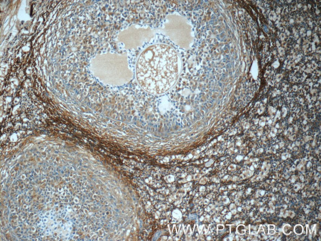 NDUFB10 Antibody in Immunohistochemistry (Paraffin) (IHC (P))