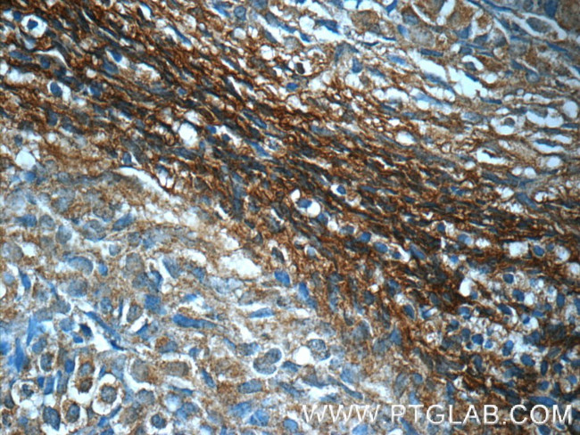 NDUFB10 Antibody in Immunohistochemistry (Paraffin) (IHC (P))