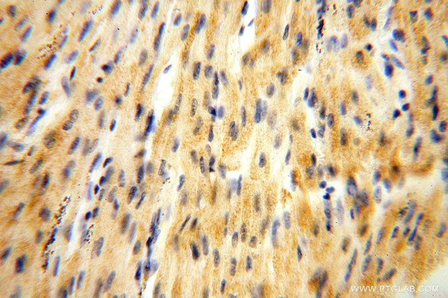 NDUFB10 Antibody in Immunohistochemistry (Paraffin) (IHC (P))