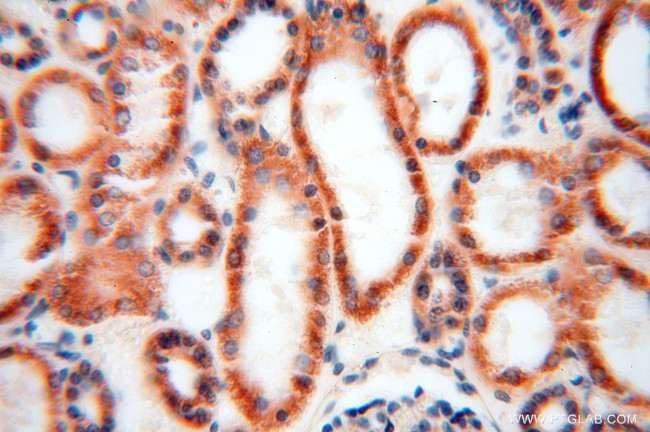 NDUFB10 Antibody in Immunohistochemistry (Paraffin) (IHC (P))