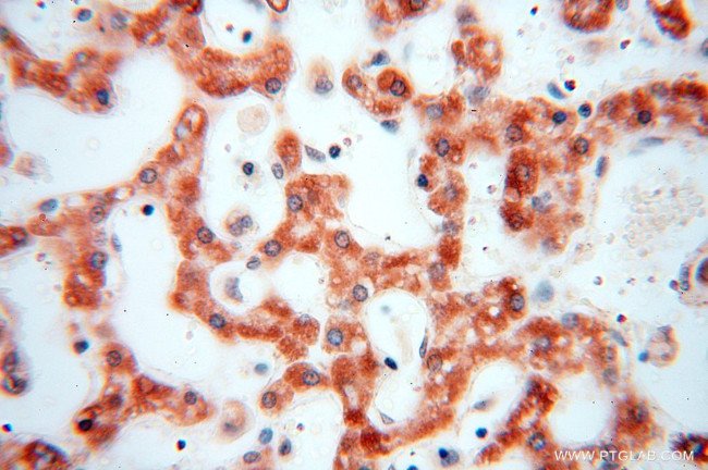 NDUFB10 Antibody in Immunohistochemistry (Paraffin) (IHC (P))