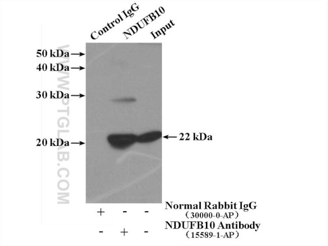 NDUFB10 Antibody in Immunoprecipitation (IP)