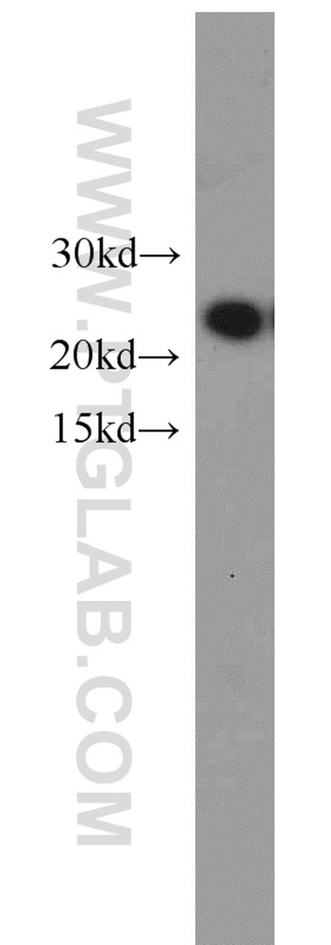 NDUFB10 Antibody in Western Blot (WB)