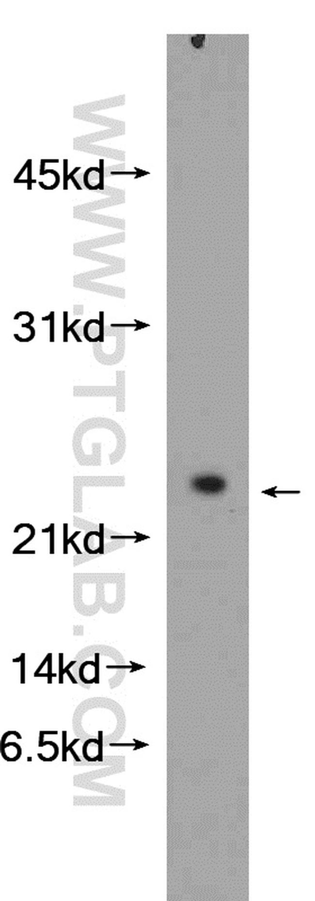 NDUFB10 Antibody in Western Blot (WB)