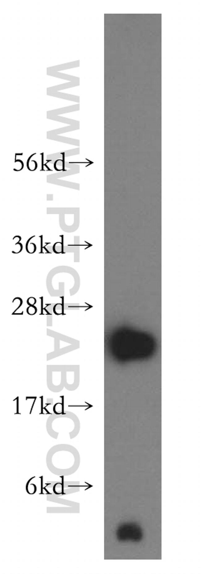 NDUFB10 Antibody in Western Blot (WB)