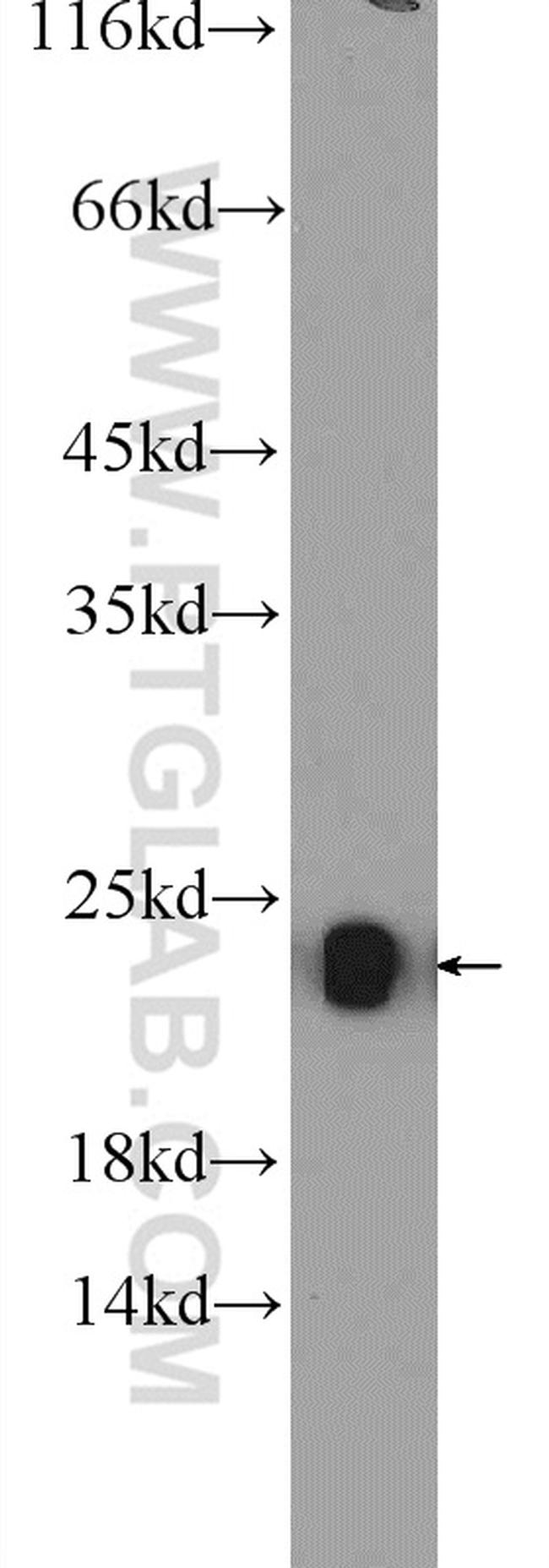 NDUFB10 Antibody in Western Blot (WB)