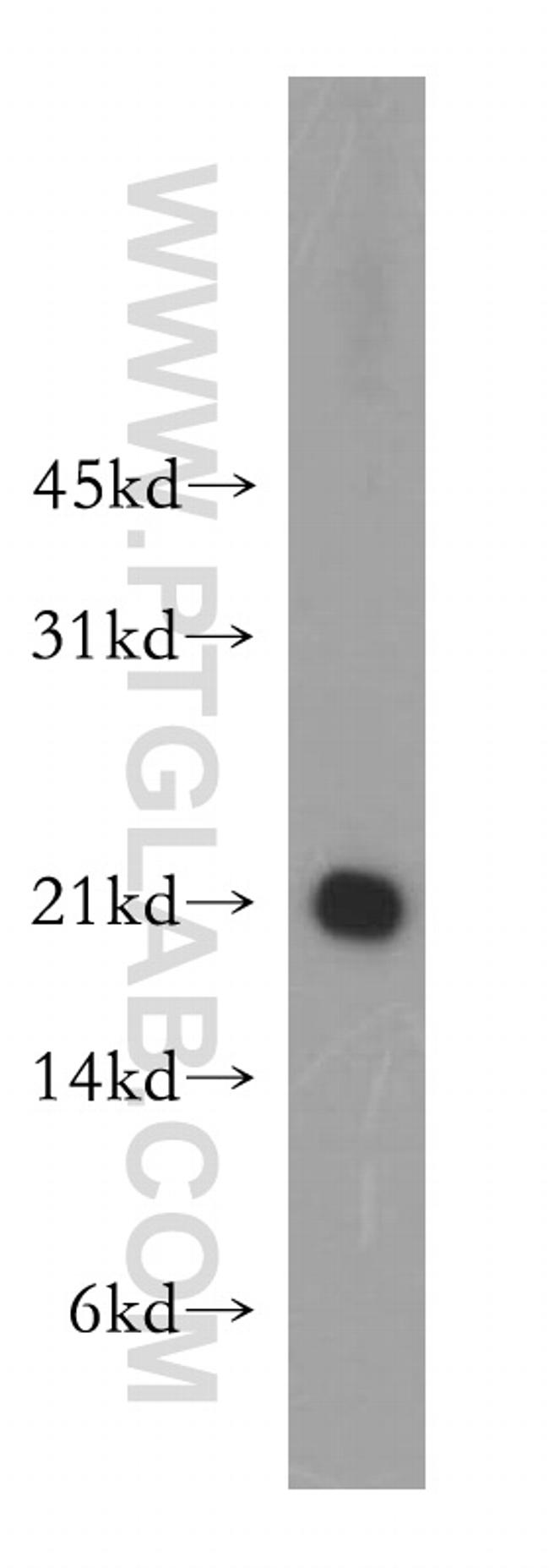 SELS Antibody in Western Blot (WB)