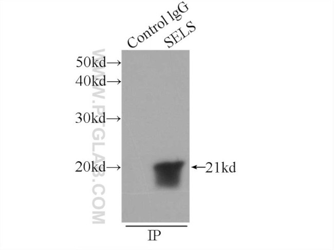 SELS Antibody in Immunoprecipitation (IP)