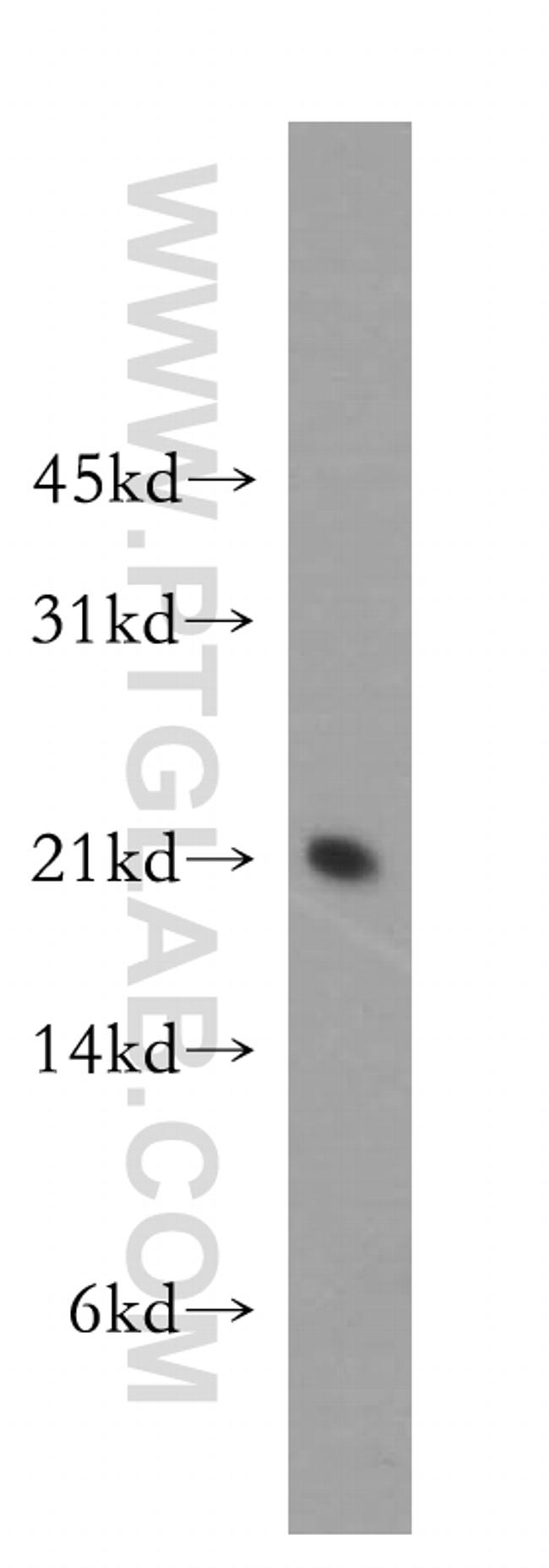 SELS Antibody in Western Blot (WB)