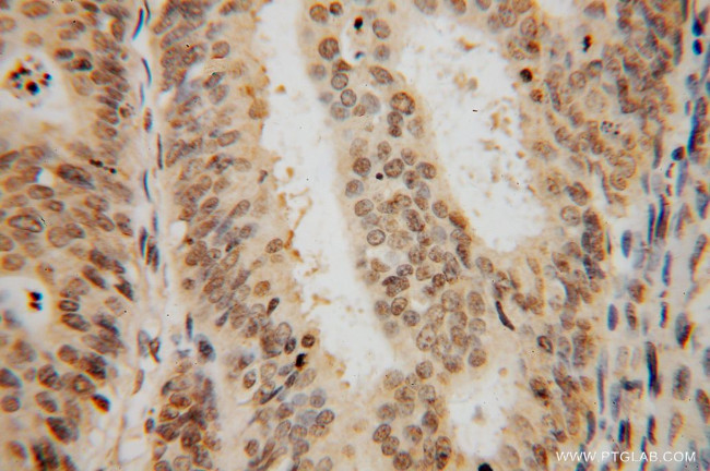 SF3A2 Antibody in Immunohistochemistry (Paraffin) (IHC (P))