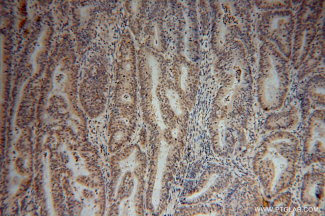 SF3A2 Antibody in Immunohistochemistry (Paraffin) (IHC (P))