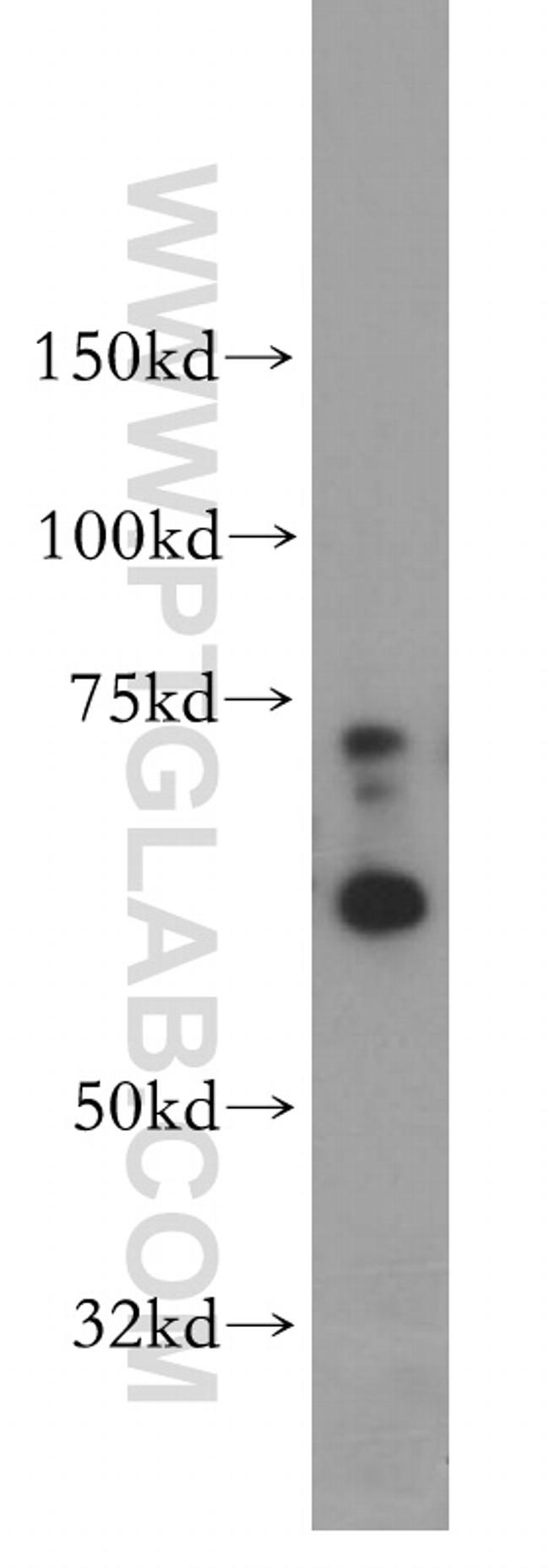 SF3A2 Antibody in Western Blot (WB)