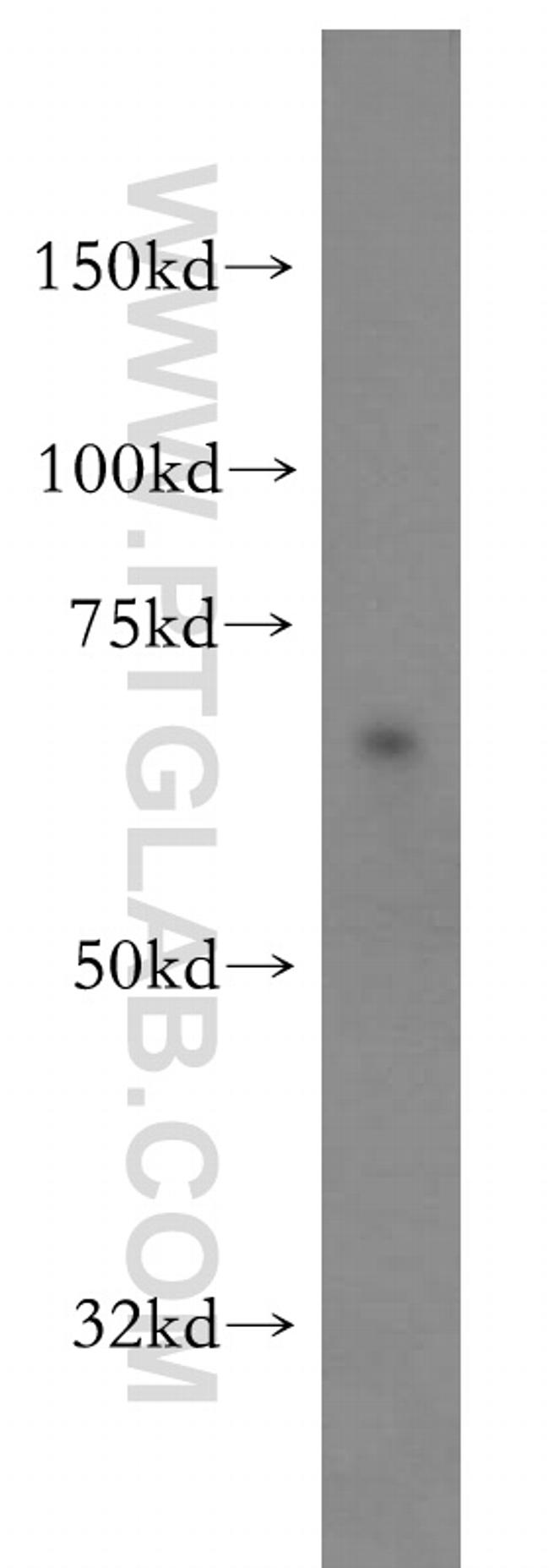 SF3A2 Antibody in Western Blot (WB)