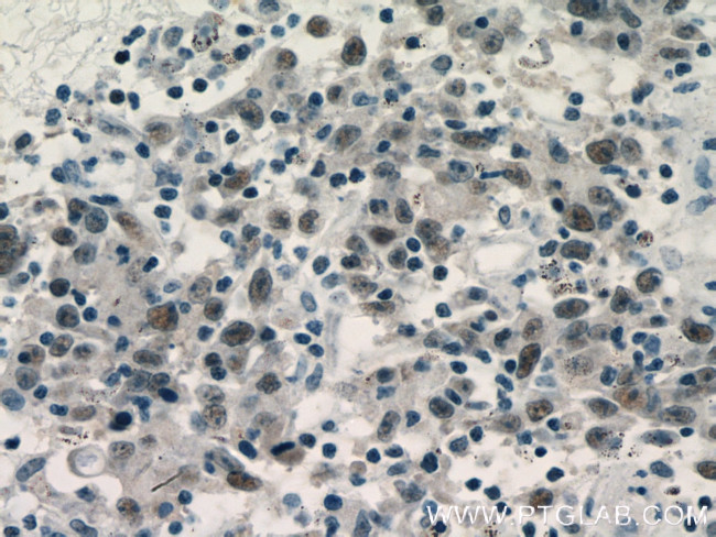 MCM3 Antibody in Immunohistochemistry (Paraffin) (IHC (P))