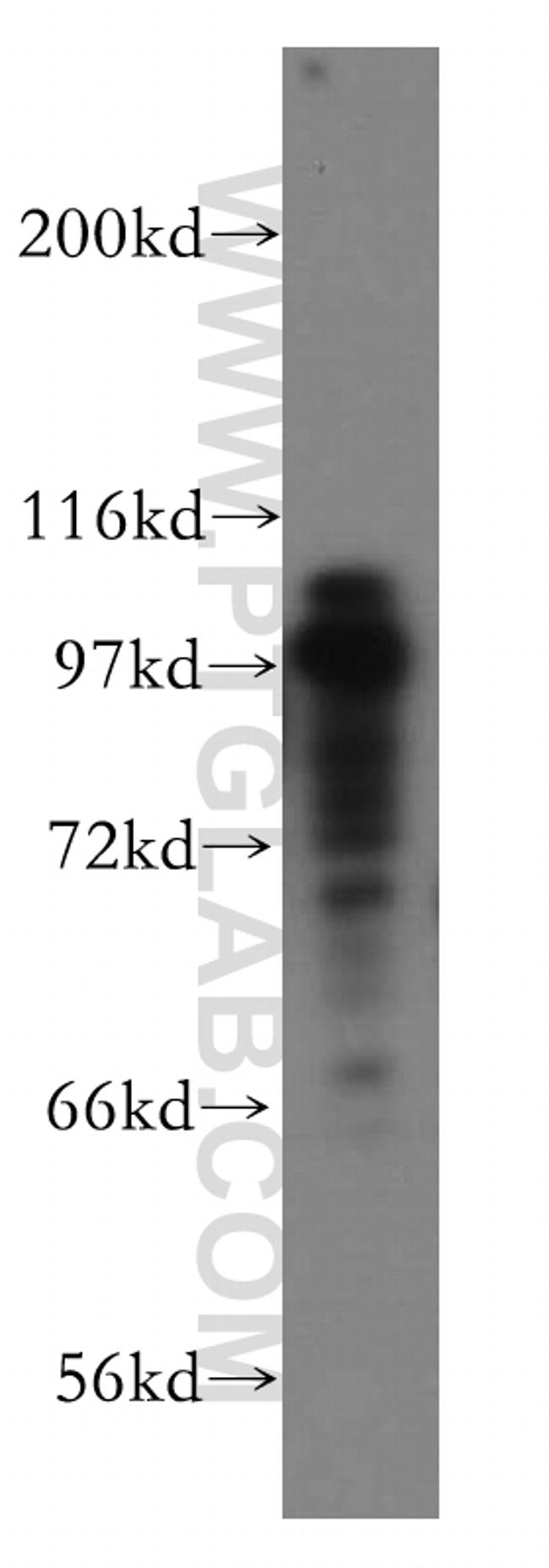 MCM3 Antibody in Western Blot (WB)