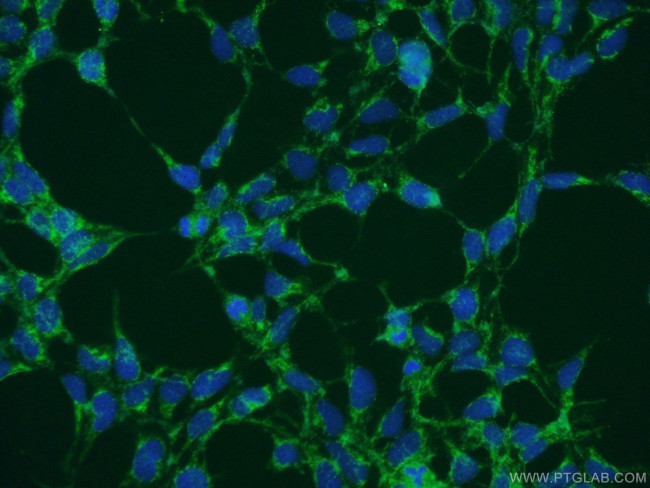 NDFIP1 Antibody in Immunocytochemistry (ICC/IF)