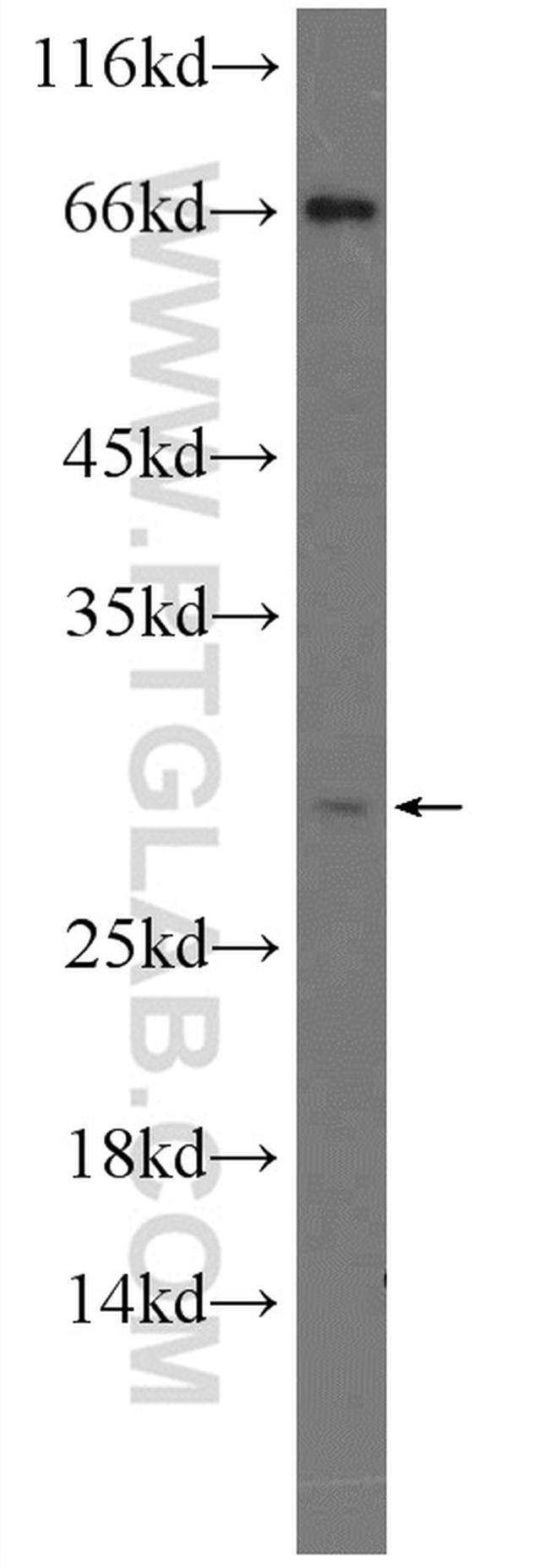 NDFIP1 Antibody in Western Blot (WB)