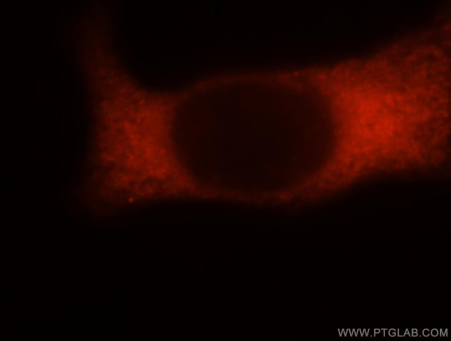 RPS16 Antibody in Immunocytochemistry (ICC/IF)