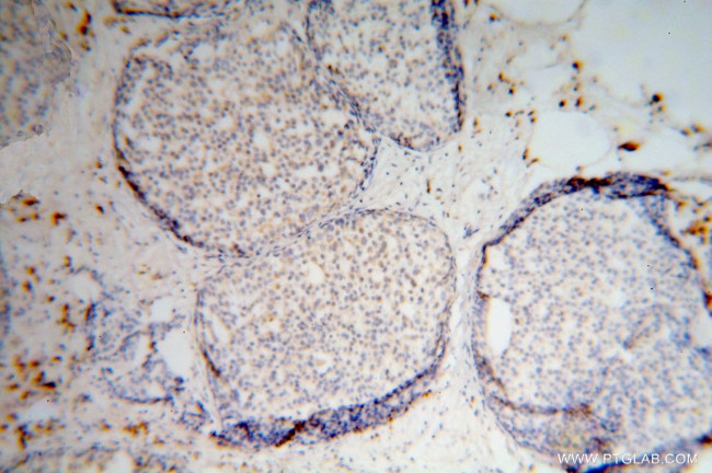 RPS16 Antibody in Immunohistochemistry (Paraffin) (IHC (P))