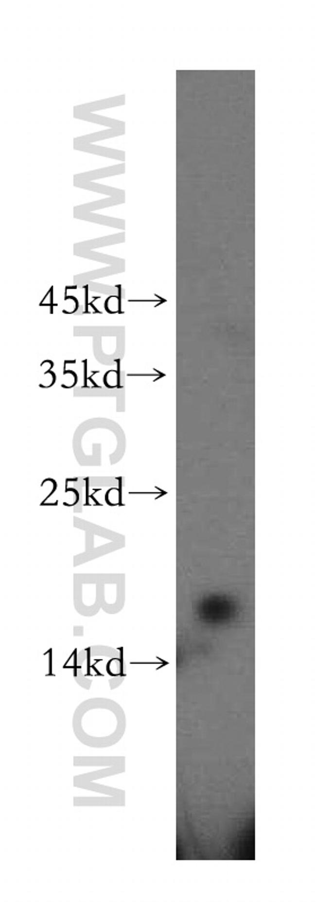 RPS16 Antibody in Western Blot (WB)