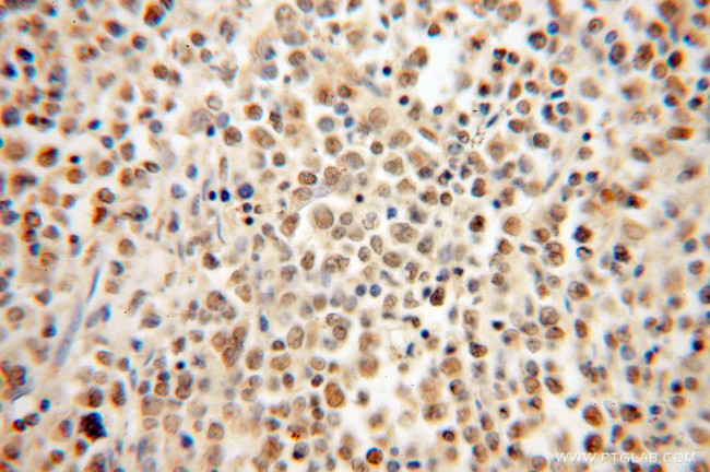 HMGB2 Antibody in Immunohistochemistry (Paraffin) (IHC (P))