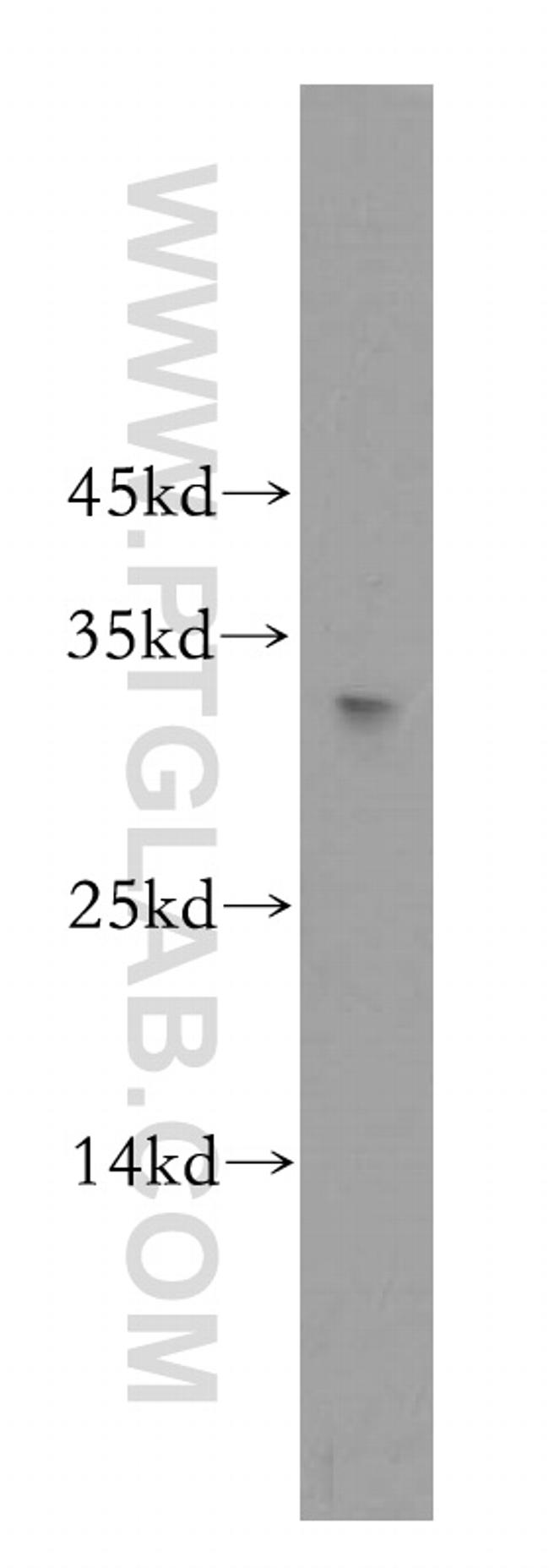 RNASEH1 Antibody in Western Blot (WB)