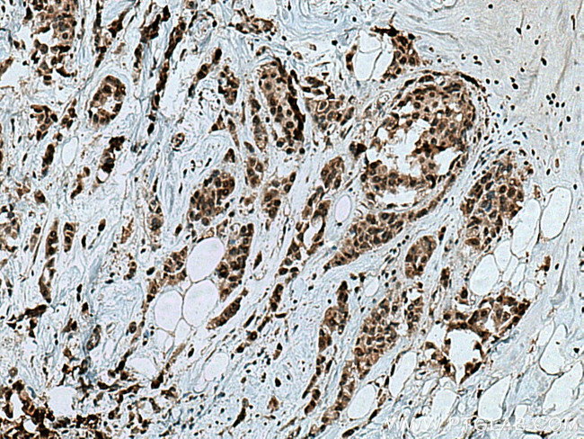 VRK3 Antibody in Immunohistochemistry (Paraffin) (IHC (P))