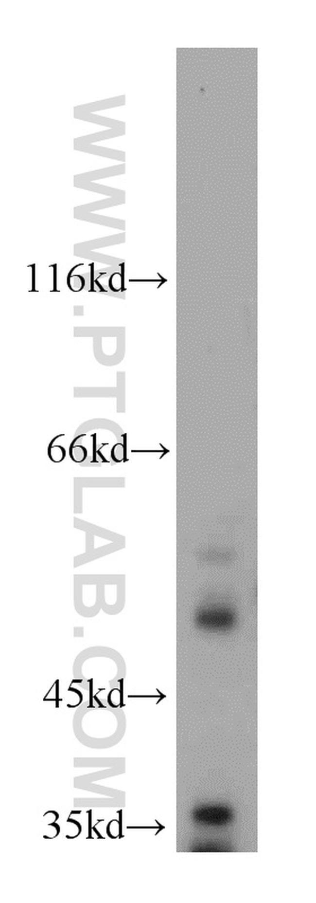 VRK3 Antibody in Western Blot (WB)