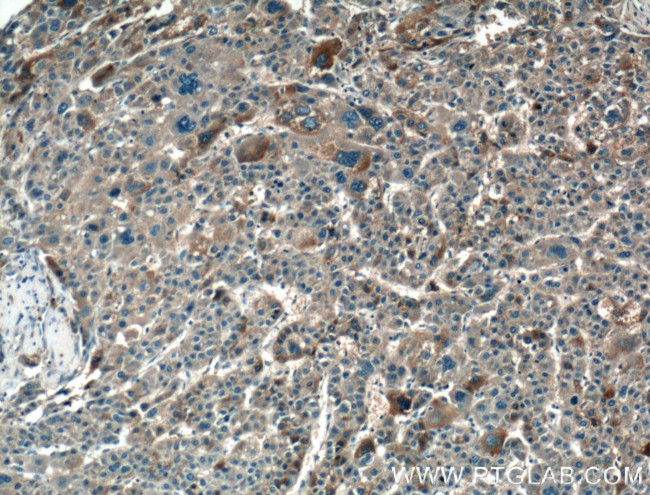 HAS3 Antibody in Immunohistochemistry (Paraffin) (IHC (P))