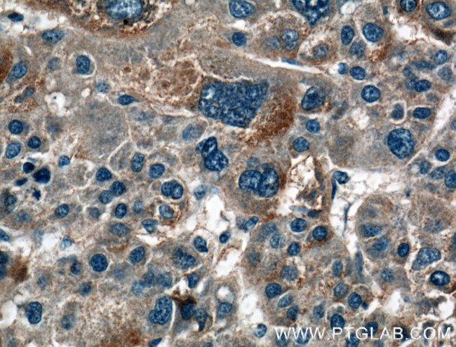 HAS3 Antibody in Immunohistochemistry (Paraffin) (IHC (P))