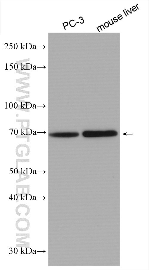 HAS3 Antibody in Western Blot (WB)